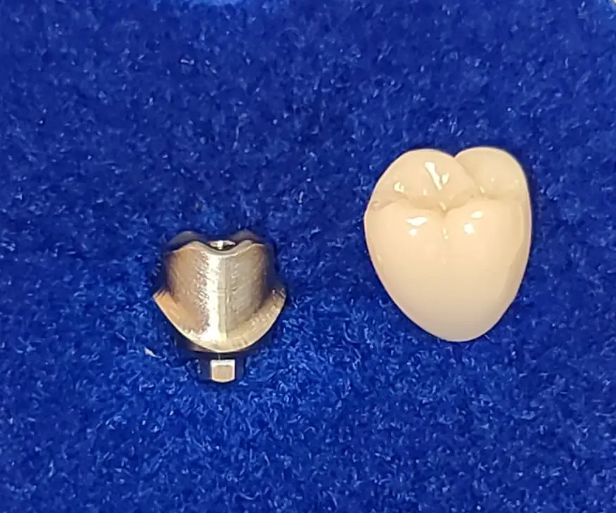 Sleep Apnea Treatment